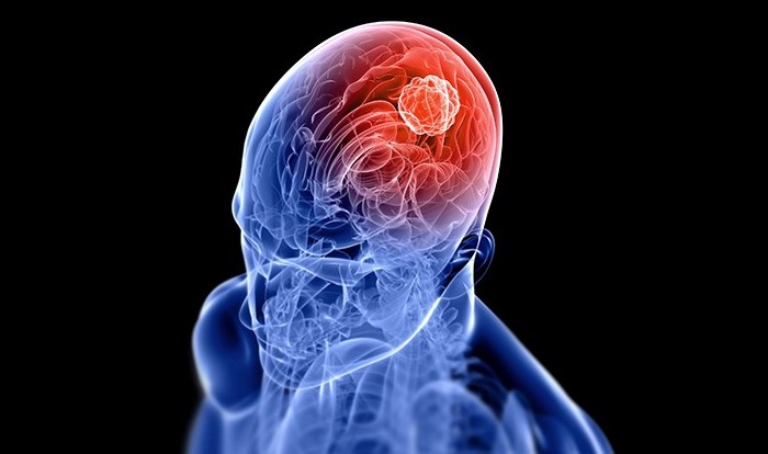 X-Rays for Cancer? When a scan is a&nbsp;scam